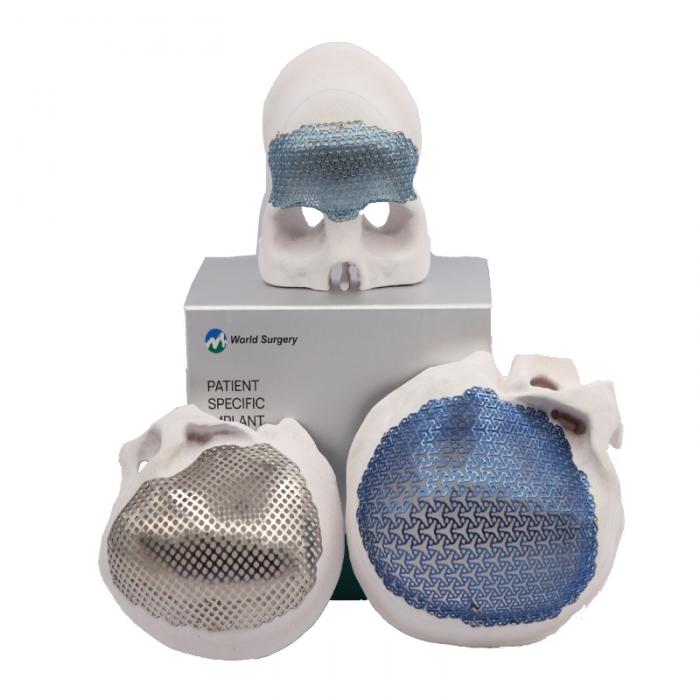 Cranial Titanium mesh