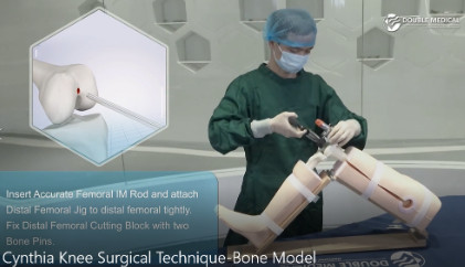 Dwukrotnie Medical Cynthia Kolan Model Demonstracja modelu kości